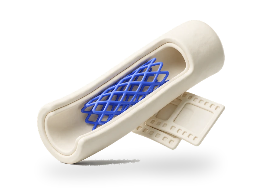 A stent expanding inside a cut-away vessel, with two film frames behind it.